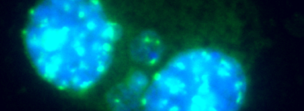 Numero 3 – Febbraio 2021 – Test dei Micronuclei MoA